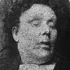 Mortuary photograph of Chapman: a middle-aged woman with short, curly hair