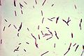 Clostridium perfringens.jpg