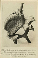 Descubierta en la actual Saalfeld, (Alemania): una flecha con punta de bronce atravesando una vertebra humana.
