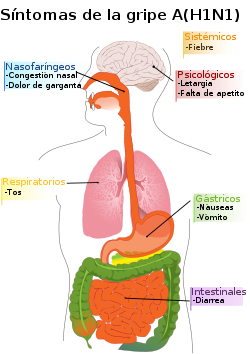Diagrama de síntomas de la gripe AH1N1.svg