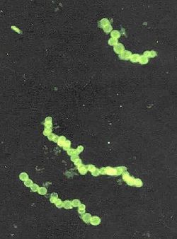 Sulphide bacteria crop.jpg