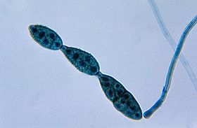 Chain of conidia of a Alternaria sp. fungus PHIL 3963 lores.jpg